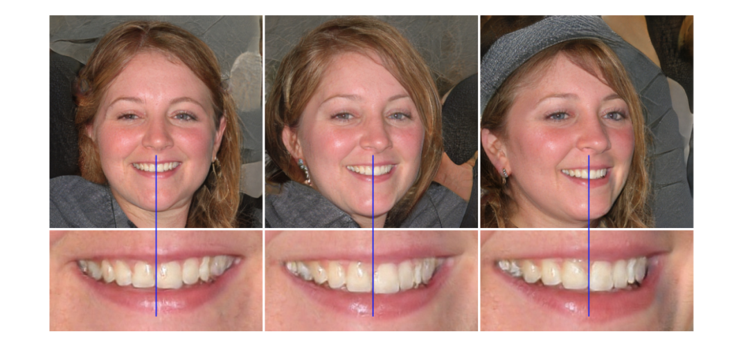 How GAN Controls Image Generation Style? Detailed StyleGAN Evolution