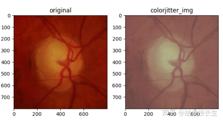 13 Image Augmentation Methods in Pytorch