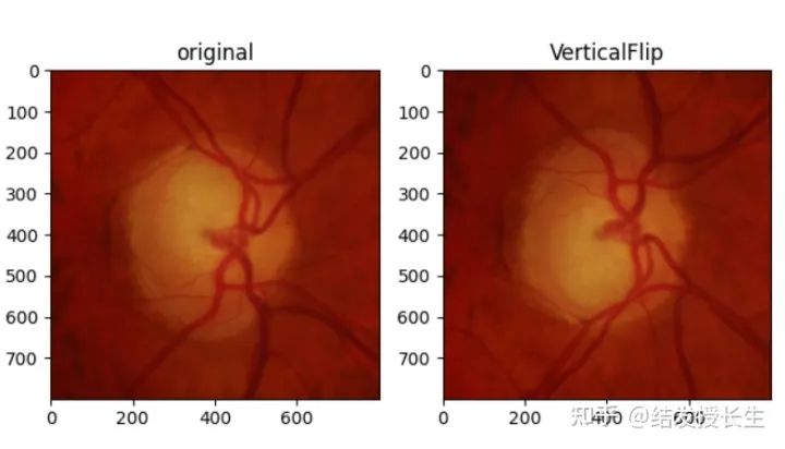 13 Practical Image Augmentation Techniques in Pytorch (With Code)