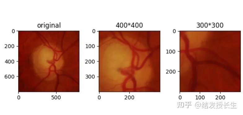 13 Practical Image Augmentation Techniques in Pytorch (With Code)