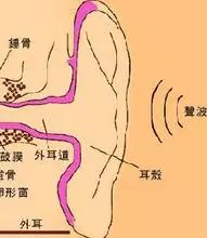 What Is Auditory? Machine Hearing?