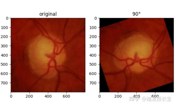 13 Image Augmentation Methods in Pytorch