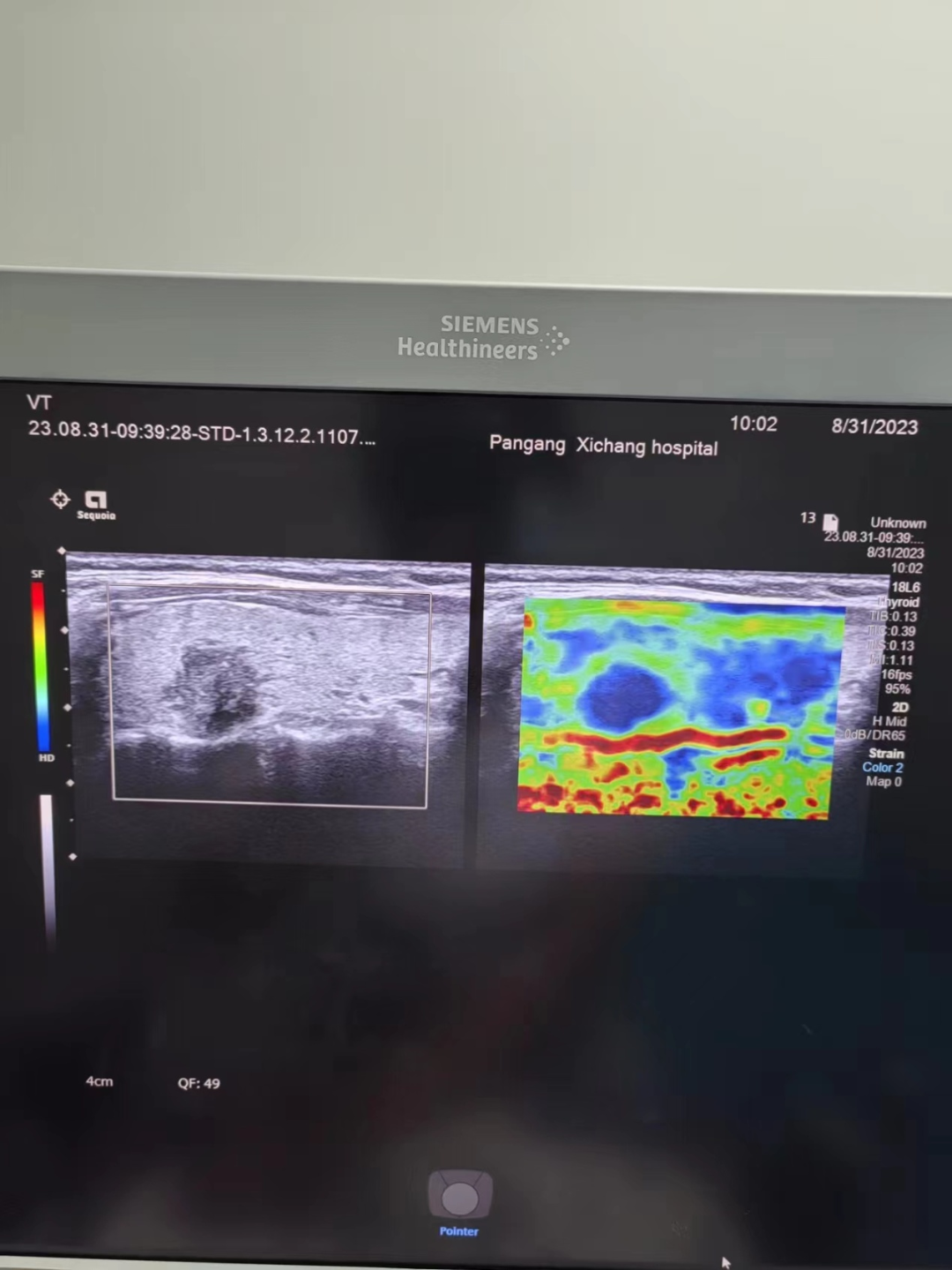 Multimodal Ultrasound Examination of Thyroid and Breast Nodules