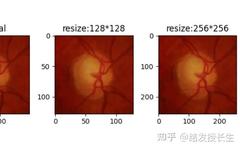 13 Image Augmentation Methods in Pytorch
