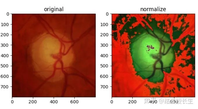 13 Image Augmentation Methods in Pytorch