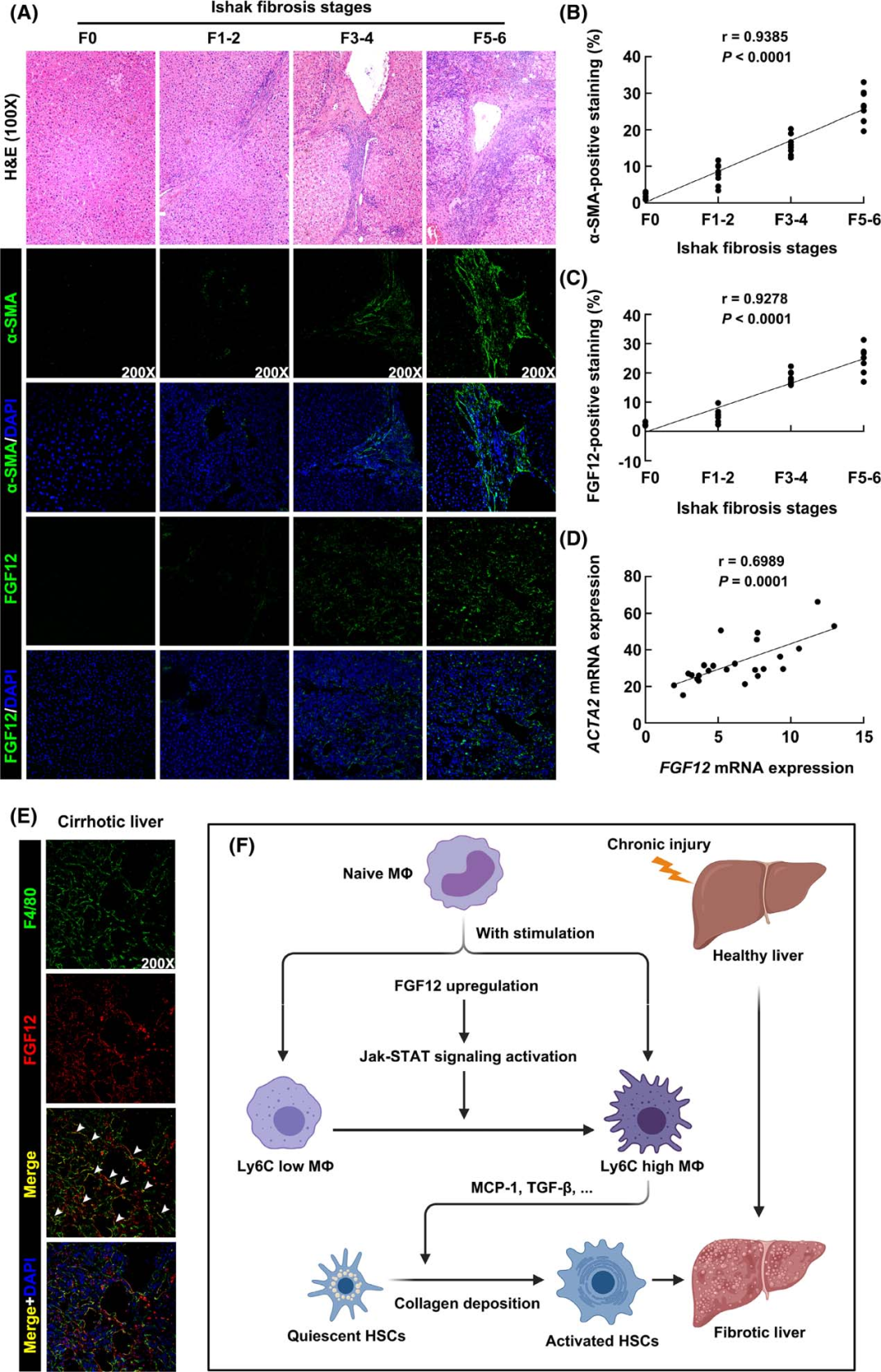Macrophage-Specific FGF12 Promotes Liver Fibrosis Progression in Mice