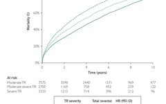 Research Approach: Building and Validating the TRIO Scoring Model