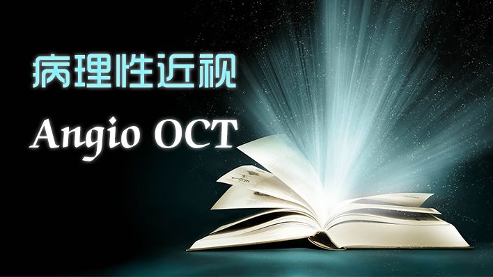 Understanding Multifocal Choroiditis Through Angio-OCT