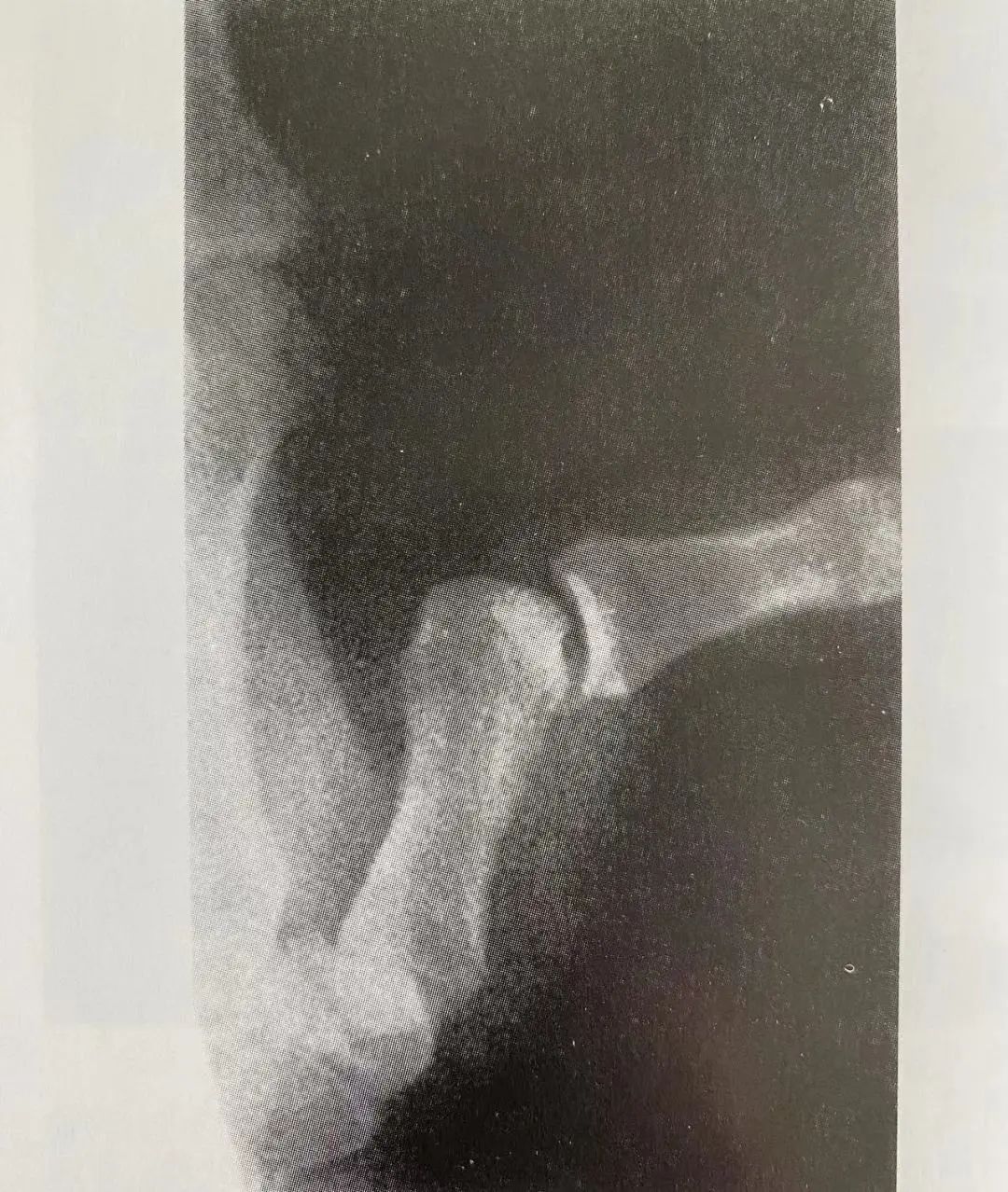 Comprehensive Summary: Treatment Strategies for Four Types of Hand Joint Injuries