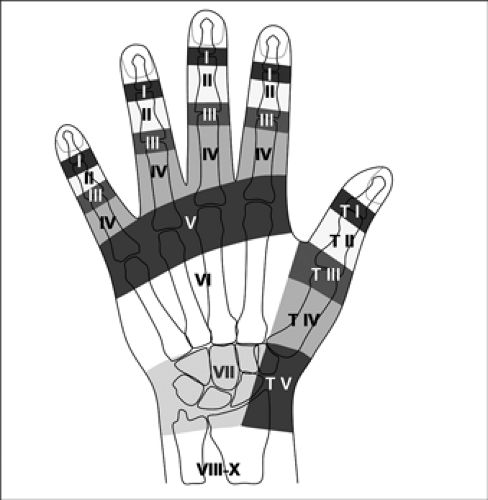 MRI of Finger Tendons