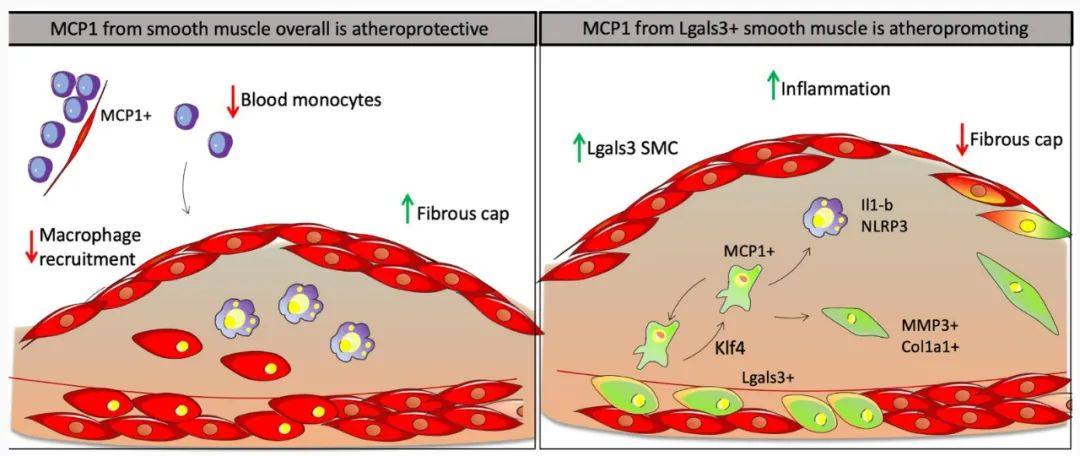 Dichotomous Roles of Smooth Muscle Cell-Derived MCP1 in Atherosclerosis Development