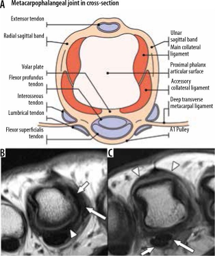 Latest Review: MRI Diagnostic Techniques for Little Finger and Thumb