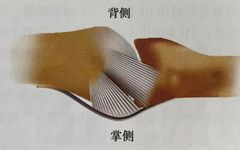 Comprehensive Summary: Treatment Strategies for Four Types of Hand Joint Injuries