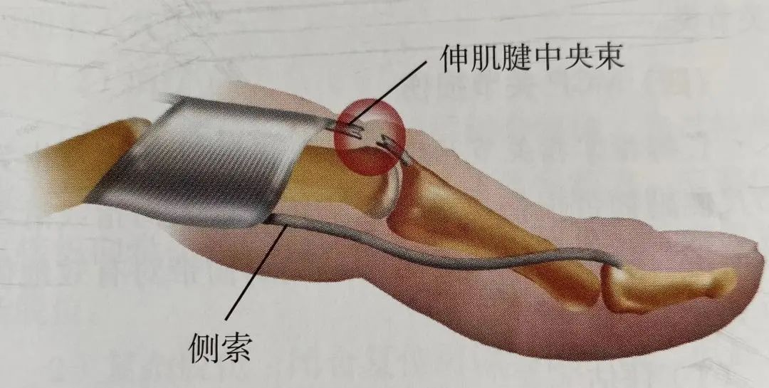 Comprehensive Summary: Treatment Strategies for Four Types of Hand Joint Injuries