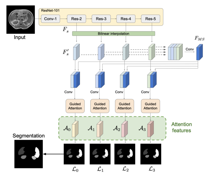 Implementing Attention Mechanism for Medical Image Segmentation in PyTorch