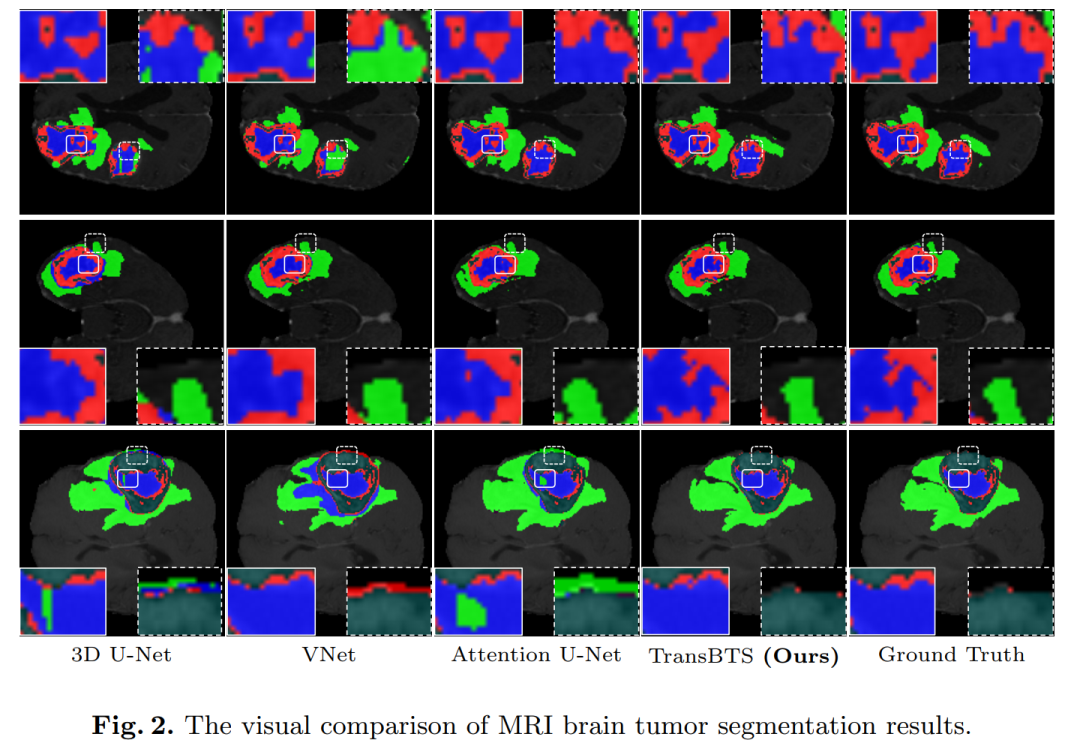When Transformer Meets U-Net: A Review of Medical Image Segmentation