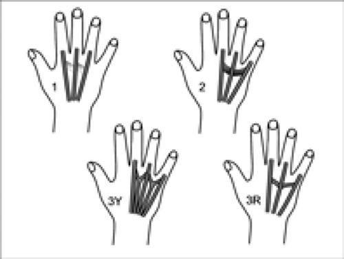 MRI of Finger Tendons