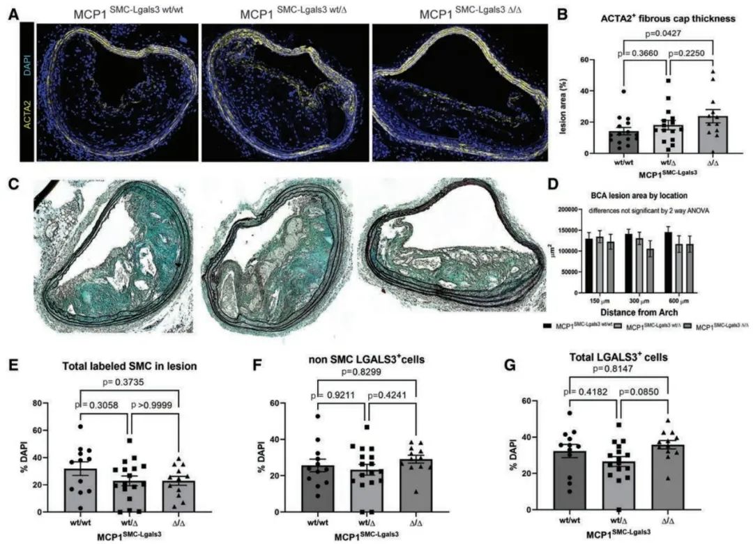 Dichotomous Roles of Smooth Muscle Cell-Derived MCP1 in Atherosclerosis Development