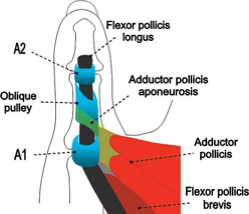 MRI of Finger Tendons