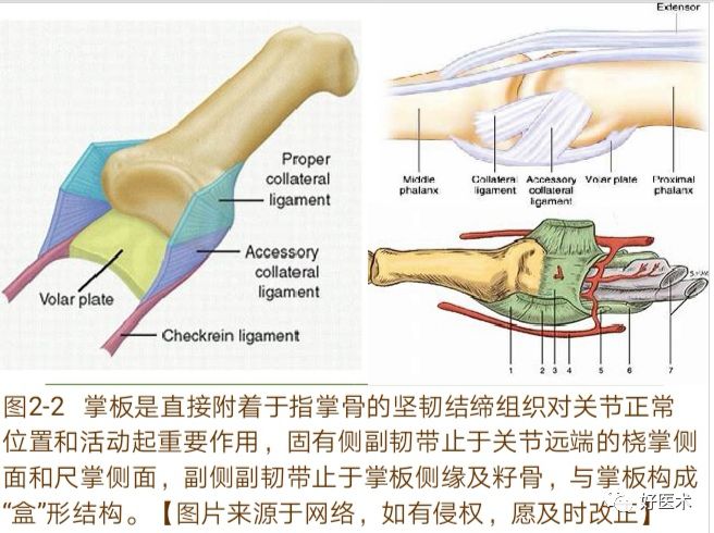 Key Points in the Diagnosis and Treatment of Metacarpophalangeal Joint Dislocation