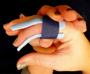 MCP And PIP Joint Arthroplasty - AAOS Orthopedic Postoperative Rehabilitation Guidelines