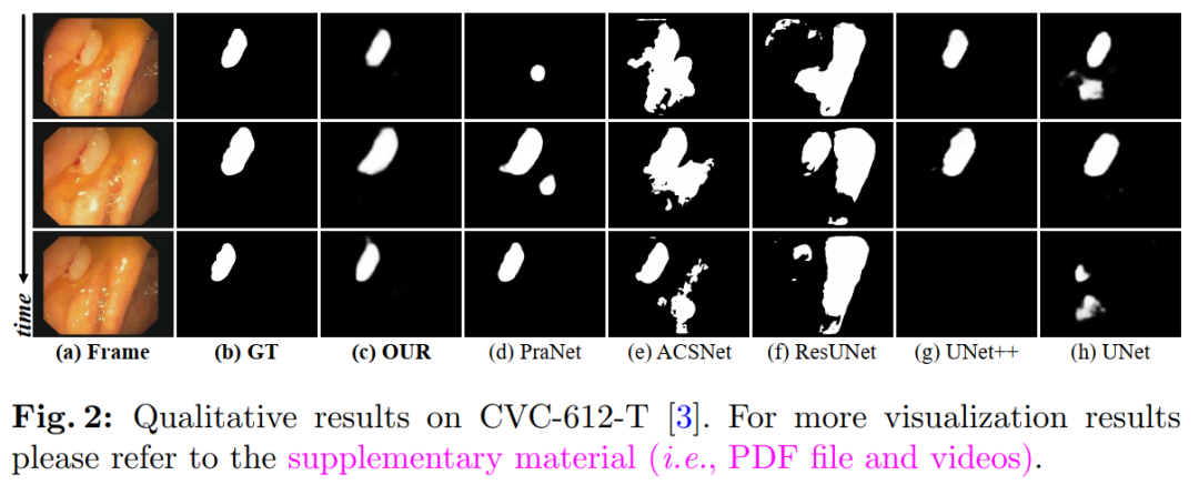 When Transformer Meets U-Net: A Review of Medical Image Segmentation