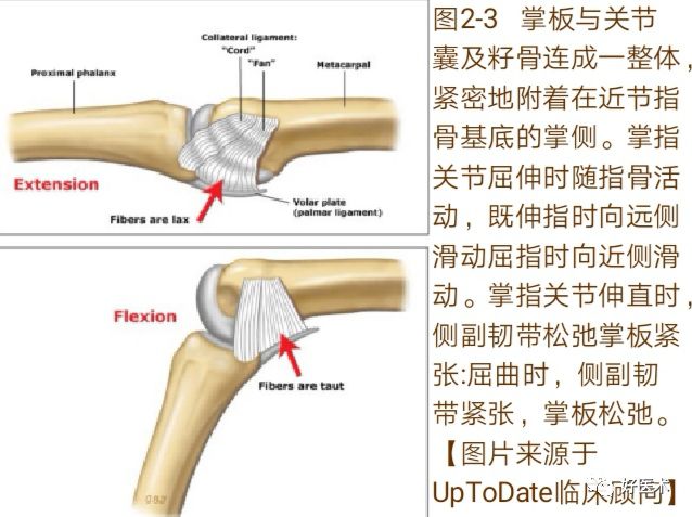 Key Points in the Diagnosis and Treatment of Metacarpophalangeal Joint Dislocation