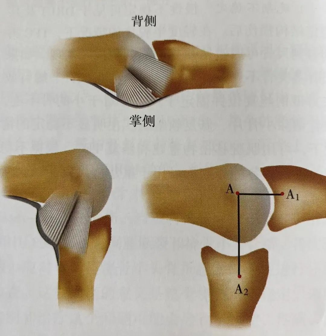 Comprehensive Summary: Treatment Strategies for Four Types of Hand Joint Injuries