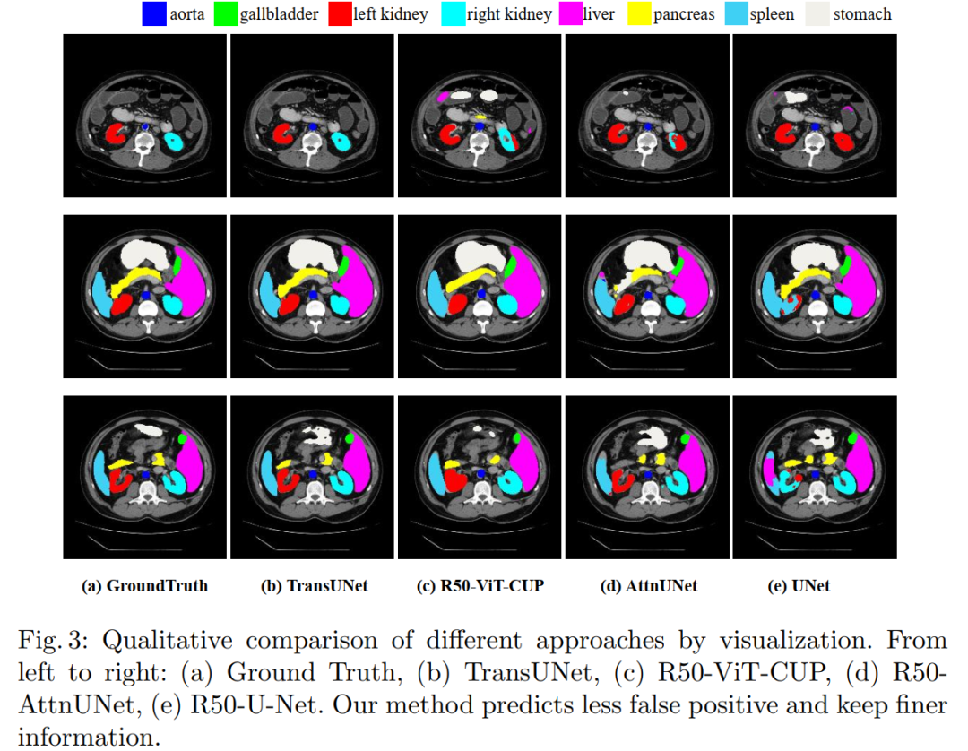 When Transformer Meets U-Net: A Review of Medical Image Segmentation