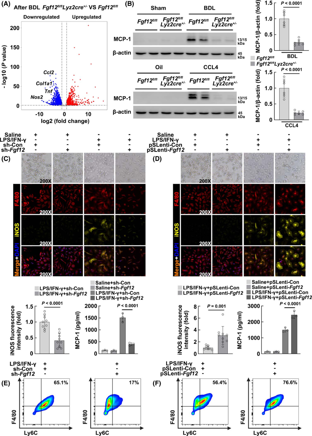 Macrophage-Specific FGF12 Promotes Liver Fibrosis Progression in Mice