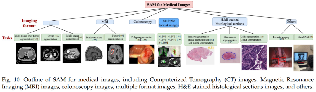 Comprehensive Survey on Segment Anything Model (SAM)