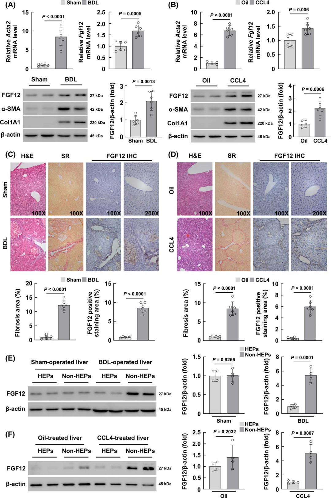 Macrophage-Specific FGF12 Promotes Liver Fibrosis Progression in Mice
