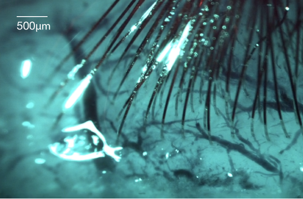 Is Mind Reading Real? How Brain-Machine Interfaces Propel Humanity Towards Transhumanism