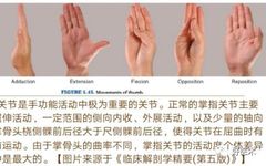 Key Points in the Diagnosis and Treatment of Metacarpophalangeal Joint Dislocation
