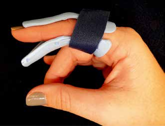 MCP And PIP Joint Arthroplasty - AAOS Orthopedic Postoperative Rehabilitation Guidelines