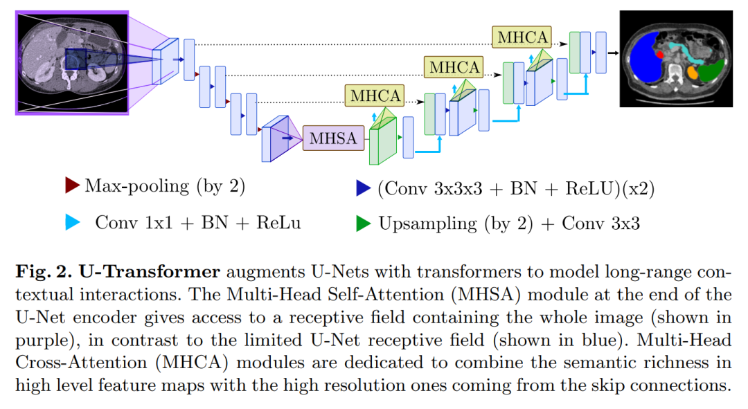 When Transformer Meets U-Net: A Review of Medical Image Segmentation