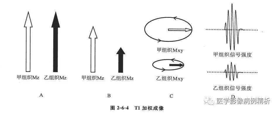 Understanding MR Imaging Technology and Clinical Application Techniques