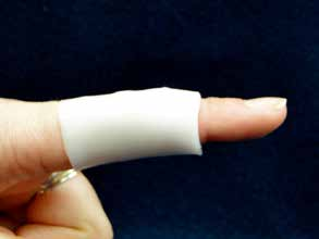 MCP And PIP Joint Arthroplasty - AAOS Orthopedic Postoperative Rehabilitation Guidelines