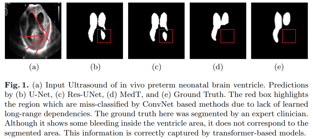 When Transformer Meets U-Net: A Review of Medical Image Segmentation
