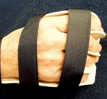 MCP And PIP Joint Arthroplasty - AAOS Orthopedic Postoperative Rehabilitation Guidelines