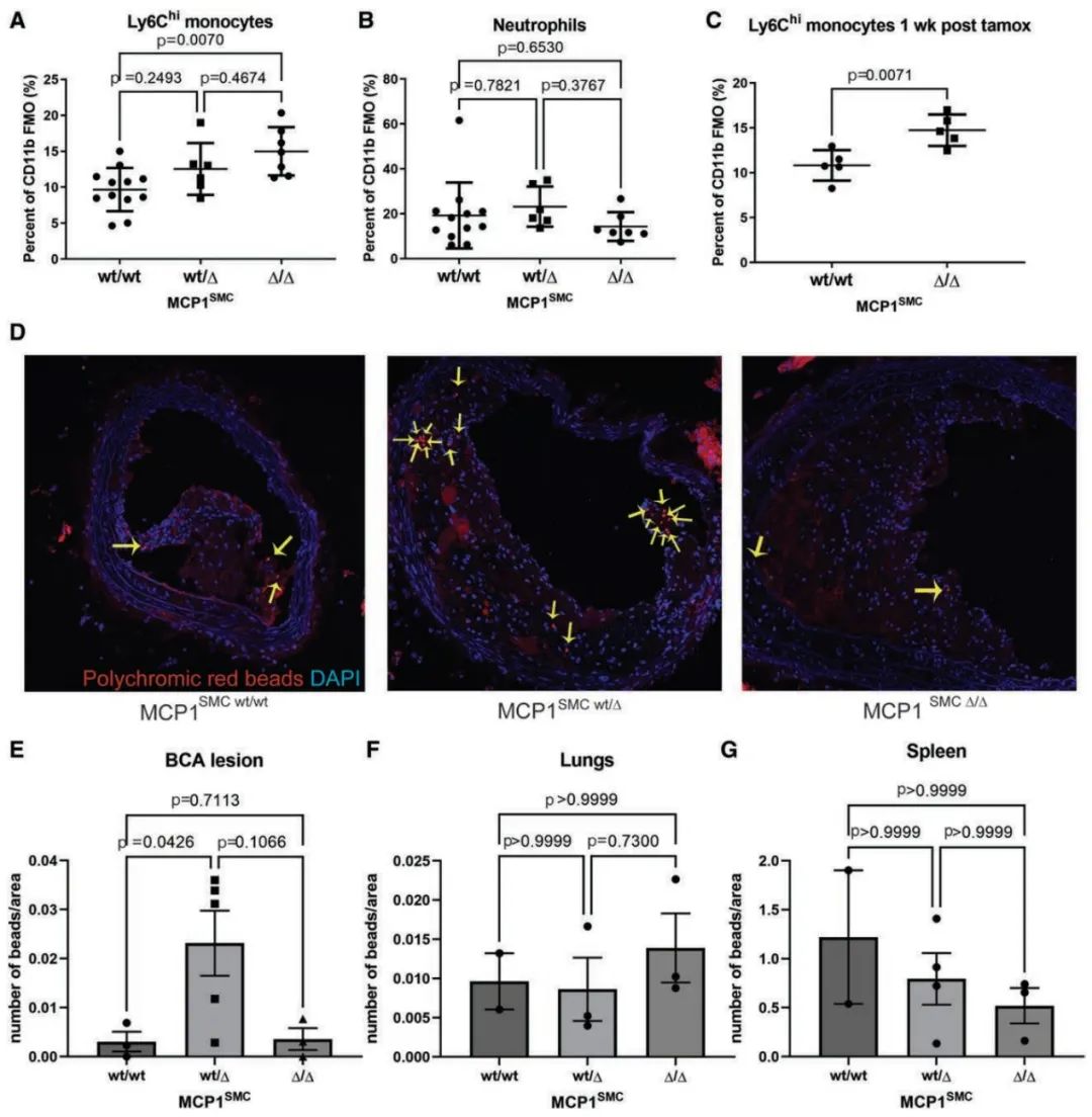 Dichotomous Roles of Smooth Muscle Cell-Derived MCP1 in Atherosclerosis Development