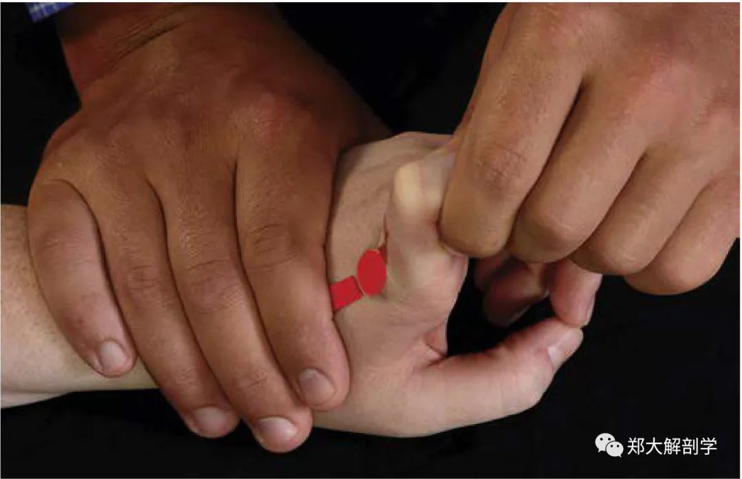 MCP or PIP/DIP Joint Extension Assessment