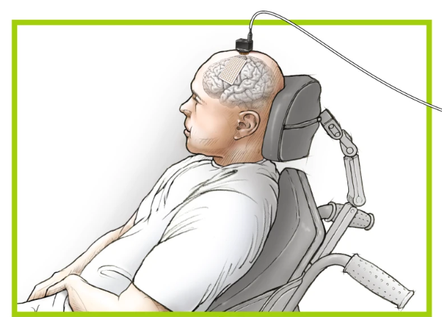 Decoding Natural Language from Brain Activity: Tasks and Cutting-Edge Methods