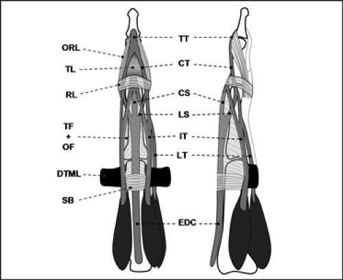 MRI of Finger Tendons