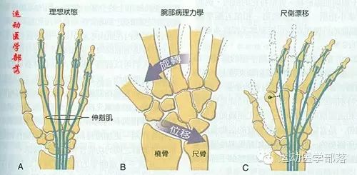 Kinesiology - Study Notes on Wrist and Hand Joints