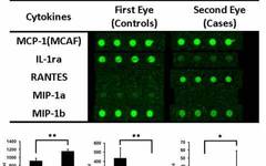 Why Is the Contralateral Eye More Sensitive During Cataract Surgery?