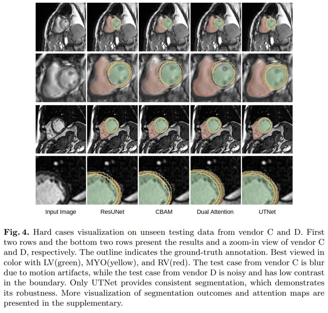 When Transformer Meets U-Net: A Review of Medical Image Segmentation