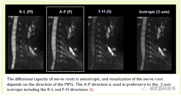 Understanding Contrast Parameters in Philips MRI Operations