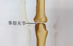 Key Points of Three Types of Hand Joint Injuries