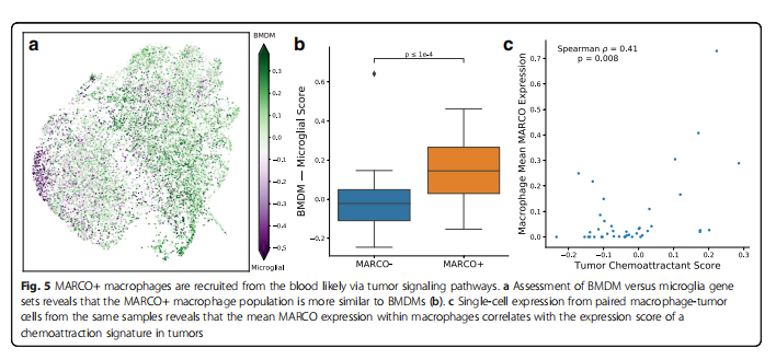 Single-Cell Features of Glioblastoma Macrophages Reveal MARCO as a Stroma-Related Tumor Marker